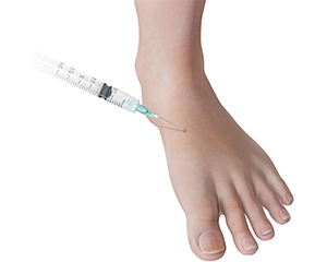 Cortisone Injection