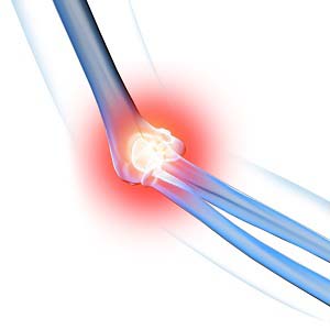 Chronic Elbow Pain