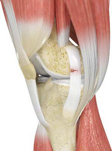 Knee Ligament Injuries